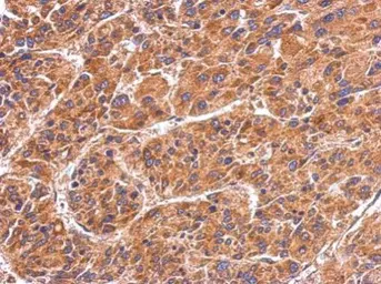 Anti-HSPA4 antibody [N3C2], Internal used in IHC (Paraffin sections) (IHC-P). GTX112607