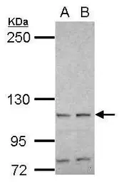 Anti-HSPA4 antibody [N3C2], Internal used in Western Blot (WB). GTX112607