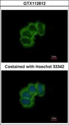 Anti-eIF4B antibody [N1N2], N-term used in Immunocytochemistry/ Immunofluorescence (ICC/IF). GTX112612