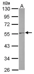 Anti-NAP1L1 antibody used in Western Blot (WB). GTX112613