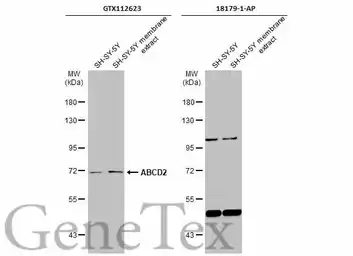 Anti-ABCD2 antibody [N3C2], Internal used in Western Blot (WB). GTX112623