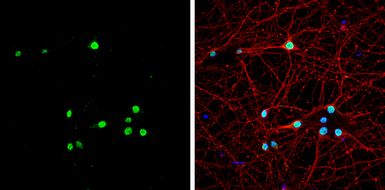 Anti-Muscleblind-like 1 antibody used in Immunocytochemistry/ Immunofluorescence (ICC/IF). GTX112624
