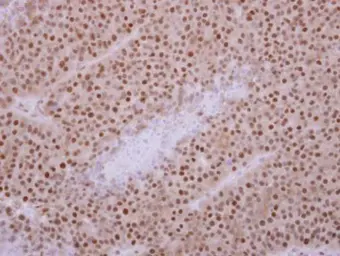 Anti-KIF3C antibody used in IHC (Paraffin sections) (IHC-P). GTX112629