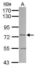 Anti-SNX1 antibody used in Western Blot (WB). GTX112635