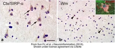 Anti-SIRP alpha antibody used in IHC (Paraffin sections) (IHC-P). GTX112645