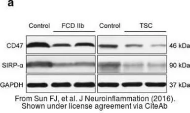 Anti-SIRP alpha antibody used in Western Blot (WB). GTX112645