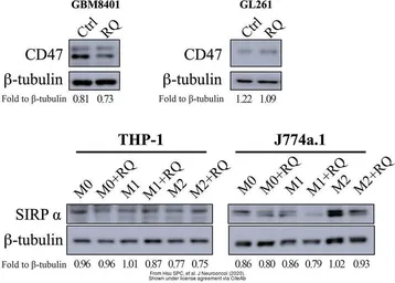 Anti-SIRP alpha antibody used in Western Blot (WB). GTX112645