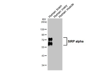 Anti-SIRP alpha antibody used in Western Blot (WB). GTX112645