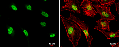 Anti-Nucleophosmin antibody used in Immunocytochemistry/ Immunofluorescence (ICC/IF). GTX112654