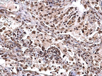 Anti-Nucleophosmin antibody used in IHC (Paraffin sections) (IHC-P). GTX112654