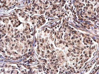 Anti-Nucleophosmin antibody used in IHC (Paraffin sections) (IHC-P). GTX112654