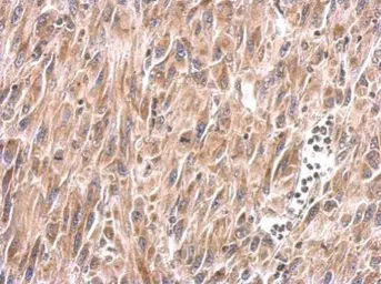 Anti-MUL1 antibody used in IHC (Paraffin sections) (IHC-P). GTX112673