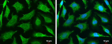 Anti-MUL1 antibody used in Immunocytochemistry/ Immunofluorescence (ICC/IF). GTX112673
