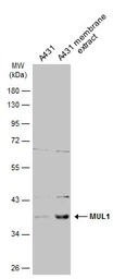 Anti-MUL1 antibody used in Western Blot (WB). GTX112673