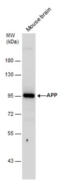 Anti-APP antibody used in Western Blot (WB). GTX112677