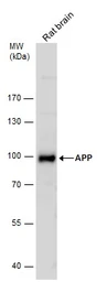 Anti-APP antibody used in Western Blot (WB). GTX112677