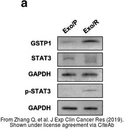 Anti-GSTP1 antibody used in Western Blot (WB). GTX112695