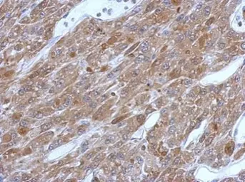 Anti-GSTP1 antibody used in IHC (Paraffin sections) (IHC-P). GTX112695