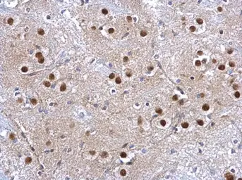 Anti-GSTP1 antibody used in IHC (Paraffin sections) (IHC-P). GTX112695