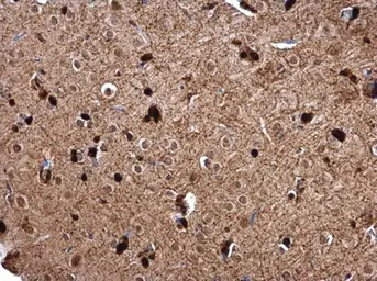 Anti-GSTP1 antibody used in IHC (Paraffin sections) (IHC-P). GTX112695