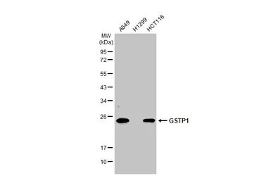 Anti-GSTP1 antibody used in Western Blot (WB). GTX112695