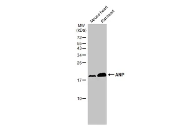 Anti-ANP antibody [N1C3] used in Western Blot (WB). GTX112698