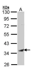Anti-BST1 antibody used in Western Blot (WB). GTX112703