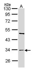 Anti-BST1 antibody [N1C3] used in Western Blot (WB). GTX112704