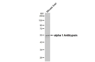 Anti-alpha 1 Antitrypsin antibody [N1C2] used in Western Blot (WB). GTX112707