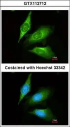 Anti-TMED4 antibody [N1C3] used in Immunocytochemistry/ Immunofluorescence (ICC/IF). GTX112712