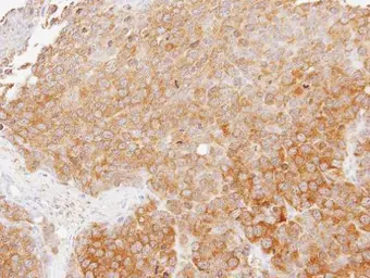 Anti-TMED4 antibody [N1C3] used in IHC (Paraffin sections) (IHC-P). GTX112712