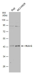 Anti-HLA-G antibody used in Western Blot (WB). GTX112713