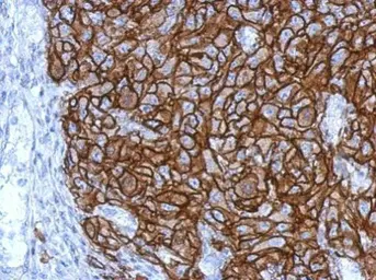 Anti-HLA-G antibody used in IHC (Paraffin sections) (IHC-P). GTX112713