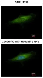 Anti-LAMP3 antibody used in Immunocytochemistry/ Immunofluorescence (ICC/IF). GTX112715