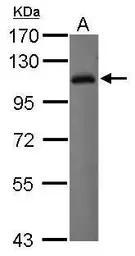 Anti-LILRB1 antibody [N1C1] used in Western Blot (WB). GTX112718
