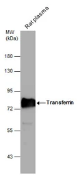 Anti-Transferrin antibody [N3C2], Internal used in Western Blot (WB). GTX112729