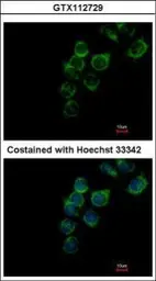 Anti-Transferrin antibody [N3C2], Internal used in Immunocytochemistry/ Immunofluorescence (ICC/IF). GTX112729
