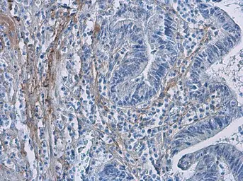Anti-COL1A1 antibody [N1N2], N-term used in IHC (Paraffin sections) (IHC-P). GTX112731