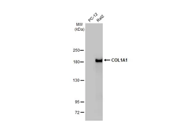 Anti-COL1A1 antibody [N1N2], N-term used in Western Blot (WB). GTX112731