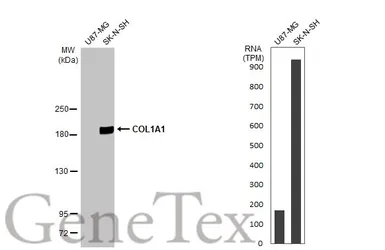 Anti-COL1A1 antibody [N1N2], N-term used in Western Blot (WB). GTX112731