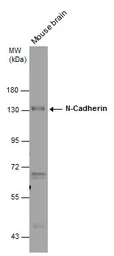 Anti-N-Cadherin antibody [N2C1], Internal used in Western Blot (WB). GTX112733