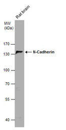 Anti-N-Cadherin antibody [N2C1], Internal used in Western Blot (WB). GTX112733