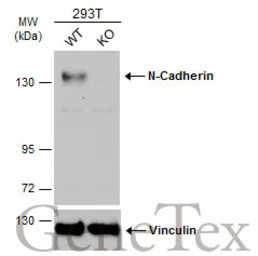 Anti-N-Cadherin antibody [N2C1], Internal used in Western Blot (WB). GTX112733