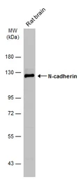 Anti-N-Cadherin antibody [N1N3] used in Western Blot (WB). GTX112734