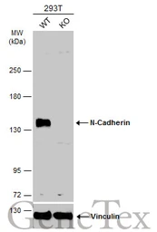 Anti-N-Cadherin antibody [N1N3] used in Western Blot (WB). GTX112734