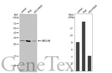Anti-BCL10 antibody used in Western Blot (WB). GTX112744