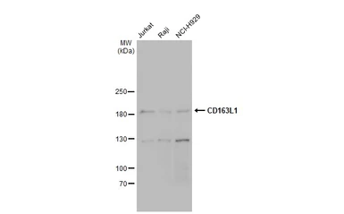 Anti-CD163L1 antibody [N1N2], N-term used in Western Blot (WB). GTX112752