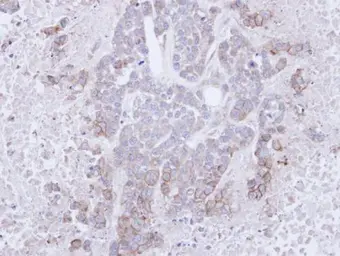 Anti-CD272 antibody used in IHC (Paraffin sections) (IHC-P). GTX112783