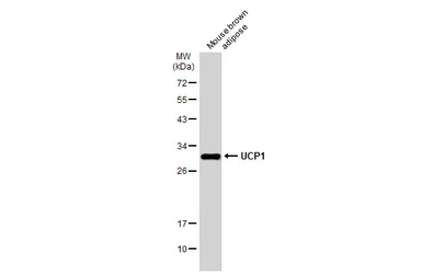 Anti-UCP1 antibody used in Western Blot (WB). GTX112784