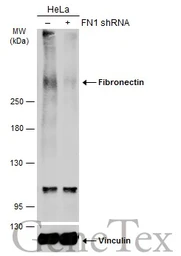 Anti-Fibronectin antibody [N1N2], N-term used in Western Blot (WB). GTX112794